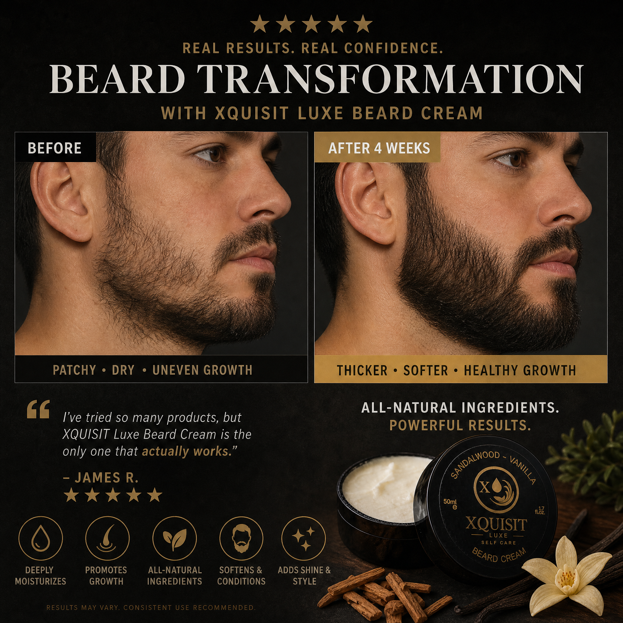 Beard Cream for Men — Nourishing & Styling Formula - Xquisit Luxe skincare & Perfume