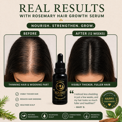 Rosemary Oil for Hair Growth — Thicker, Healthier Hair