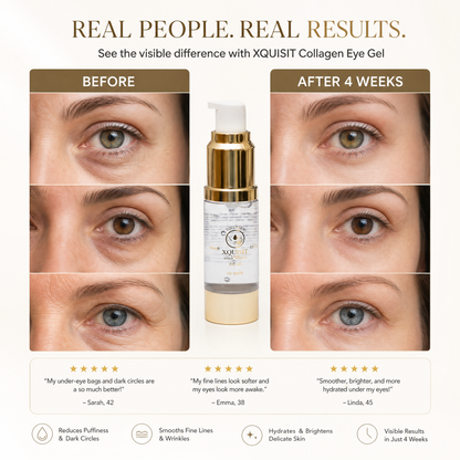 Collagen Eye Gel — Reduce Dark Circles &amp; Puffiness