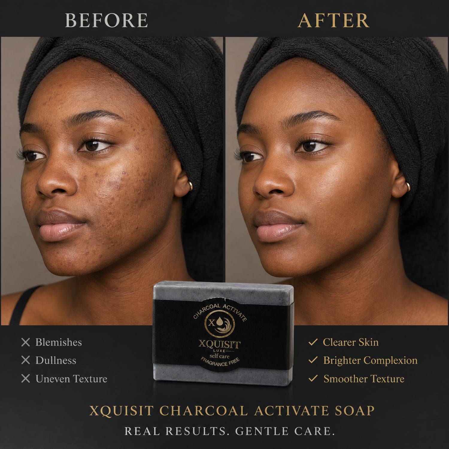 Activated Charcoal Soap — Deep Cleansing &amp; Skin Detox