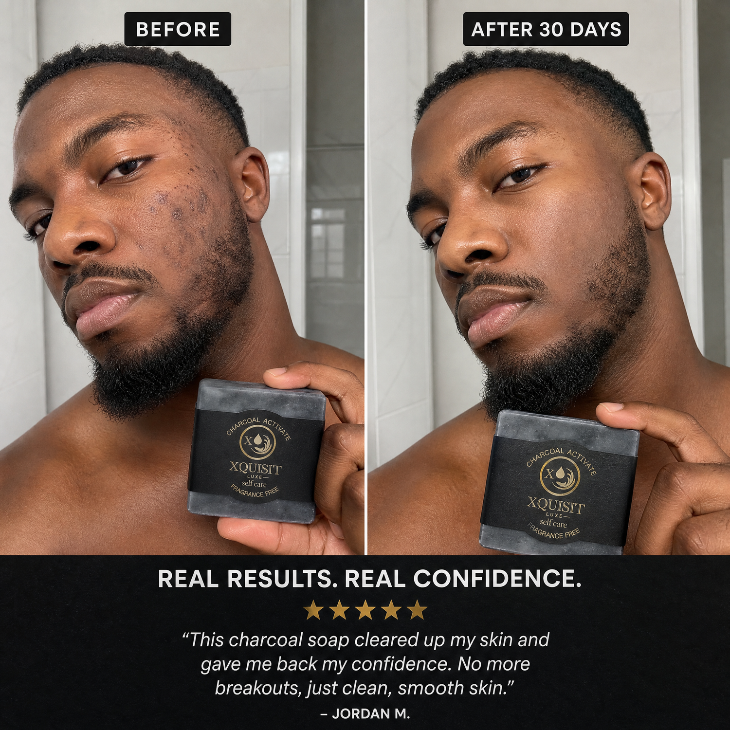 Activated Charcoal Soap — Deep Cleansing &amp; Skin Detox