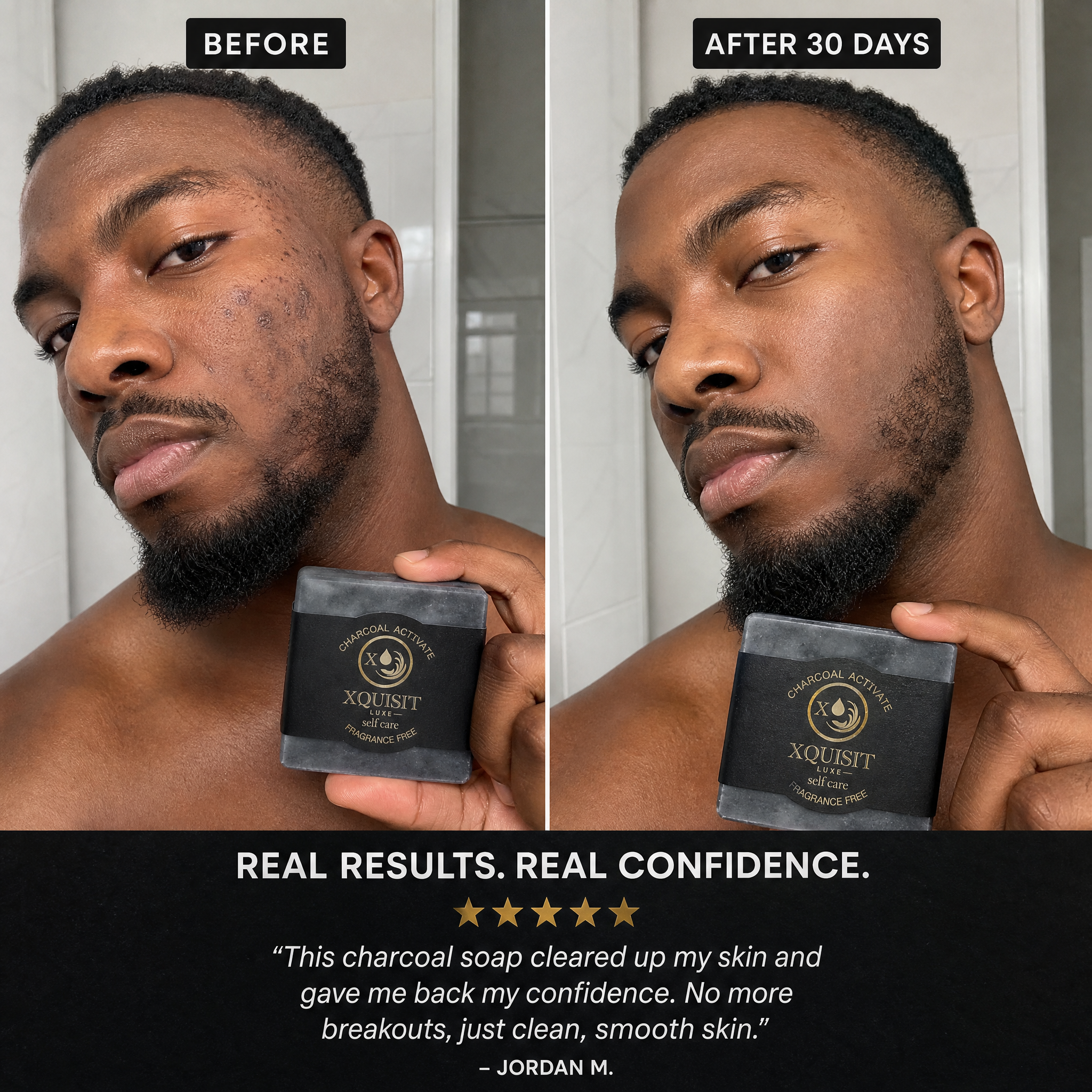 Activated Charcoal Soap — Deep Cleansing &amp; Skin Detox