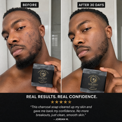 Activated Charcoal Soap — Deep Cleansing &amp; Skin Detox