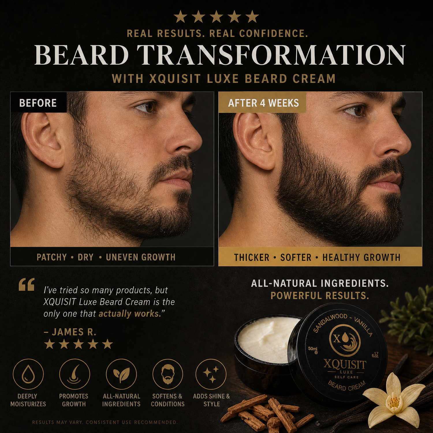 Beard Cream for Men — Nourishing &amp; Styling Formula - Xquisit Luxe skincare &amp; Perfume