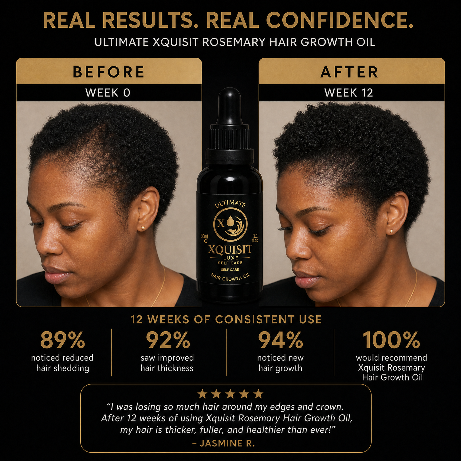 Rosemary Oil for Hair Growth — Thicker, Healthier Hair Xquisit Luxe