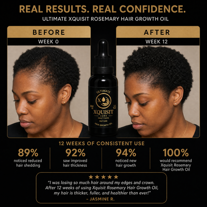 Rosemary Oil for Hair Growth — Thicker, Healthier Hair Xquisit Luxe