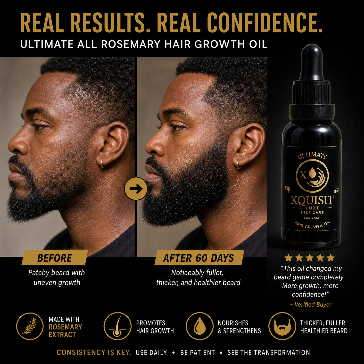 Rosemary Oil for Hair Growth — Thicker, Healthier Hair Xquisit Luxe