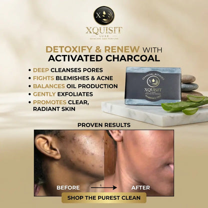 Charcoal Soap - Deep Cleansing Skin Detox
